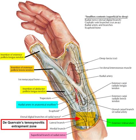 De Quervain’s Tenosynovitis - Causes, Symptoms, Test, Exercise, Surgery