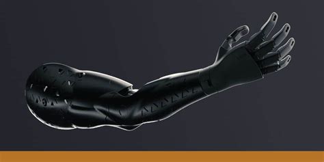 Knack - A 3D Printed Upper Limb Prosthesis - Industrial Designers Society of America