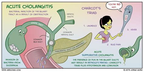 Biliary Disorders - The PA School Prescription