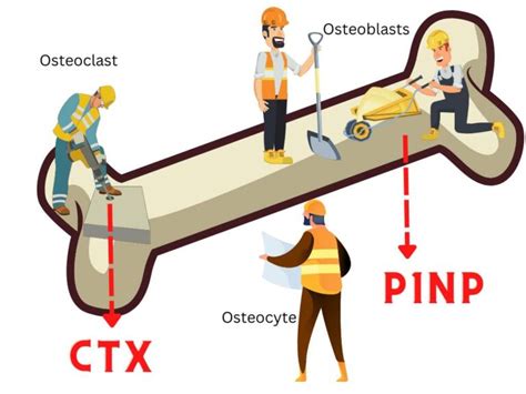 Bone Turnover Markers In Osteoporosis - My Endo Consult