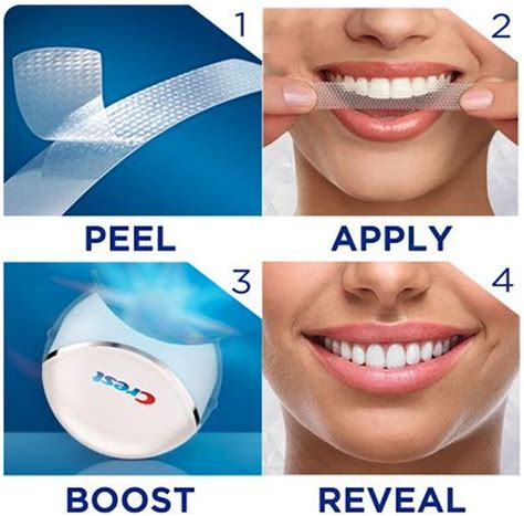 do crest whitening strips work on fillings - Very Nice To Look At Forum Picture Archive