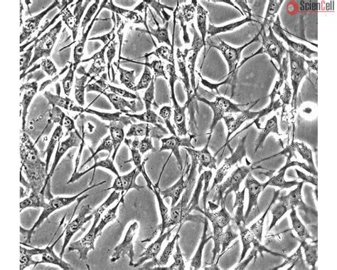 Human Skeletal Muscle Satellite Cells (HSkMSC)