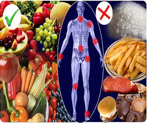 Rheumatoid Arthritis Diet Plan