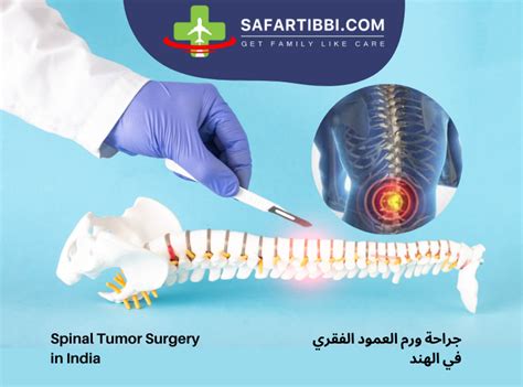 Comprehensive Guide to Spinal Tumor Surgery in India | Safartibbi