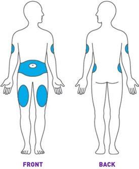 Lantus Insulin Injection Sites