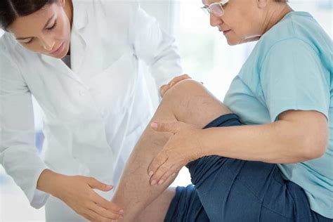 Varicose Vein Treatment Options - Burt's Rx