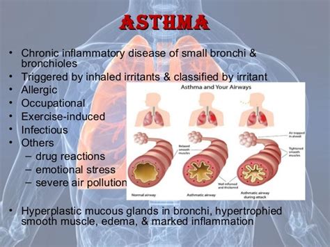 Diseases of the respiratory system