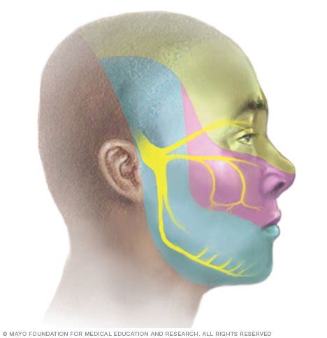 Trigeminal neuralgia Disease Reference Guide - Drugs.com