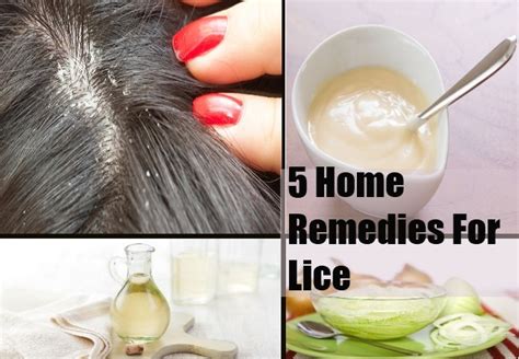 Top 5 Home Remedies For Lice - Natural Treatments & Cure For Lice | Girlishh.com