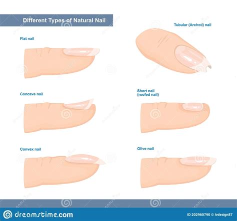 Illustration about Different Types of Fingernail. Normal, Short, Roofed, Tubular, Arched, Flat ...