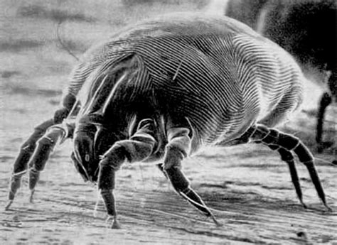 10 Tips to Get Rid of House Dust Mites | Allergies and Health