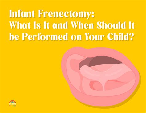 What is an Infant Frenectomy? | St. Hope Pediatrics | Houston, TX