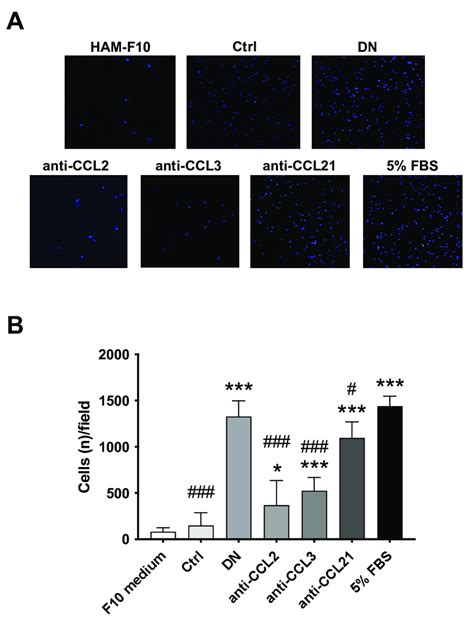 Effect of neutralizing antibodies for chemokines/chemoattractans in ...