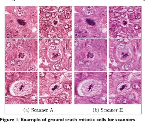 Figure 1 from Mitosis detection in breast cancer histological images An ICPR 2012 contest ...