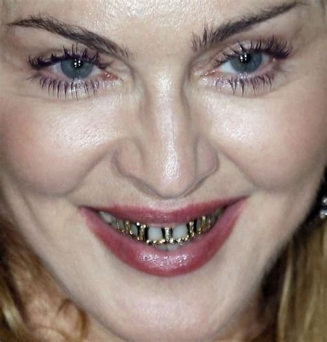 Madonna's Grillz (7 pics)