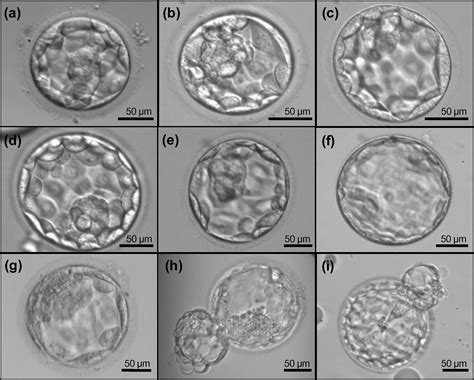 Association between blastocyst morphology and outcome of single-blastocyst transfer ...