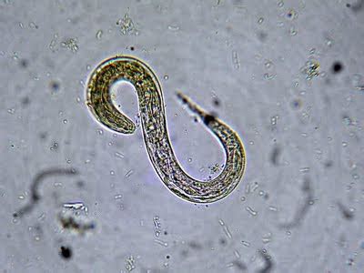 Is a skin-penetrating nematode searching for you? - BugBitten