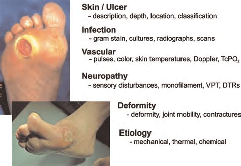 diabetic foot ulcer stages pictures - Captions Nature