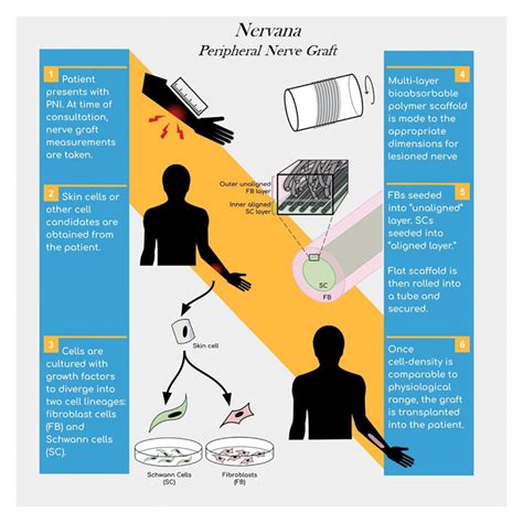 Cellularized Nerve Remediation Graft (CNRG) | Rutgers Research