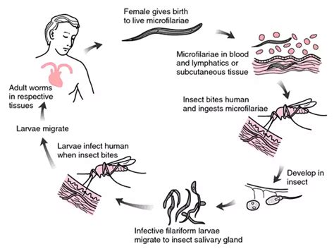 Herbal Treatment for Microfilaria-Dr Vikram Chauhan - Planet Ayurveda