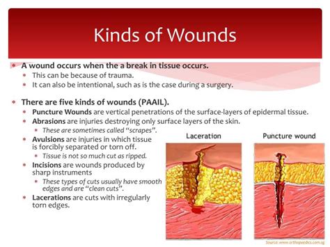 PPT - Wound Repair PowerPoint Presentation - ID:5323746