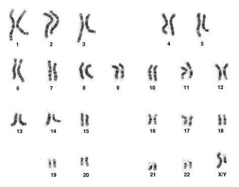 Chromosome | Notes, Videos, QA and Tests | Class 10>Science>Heredity | SaralMind