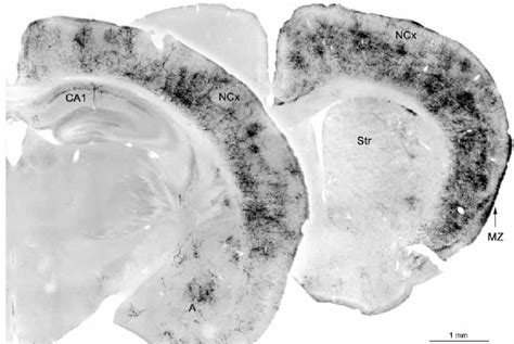 Basal Forebrain | Semantic Scholar