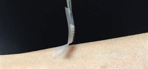 New 'smart insulin patch' could put an end to painful insulin ...