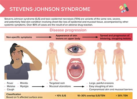 Steven Johnson Syndrome Early Stages