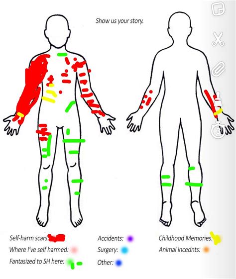 Scar map : r/SelfHarmScars