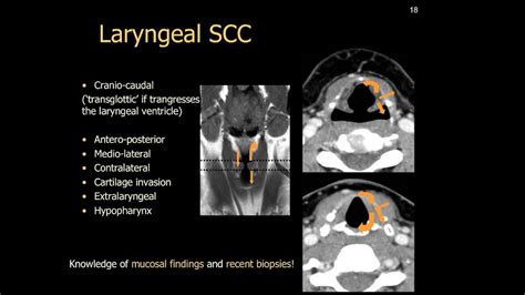 Hypopharynx Xray