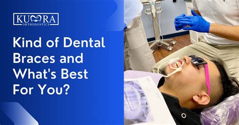 Choosing the Best Dental Braces for a Perfect Smile | Kumra Orthodontics