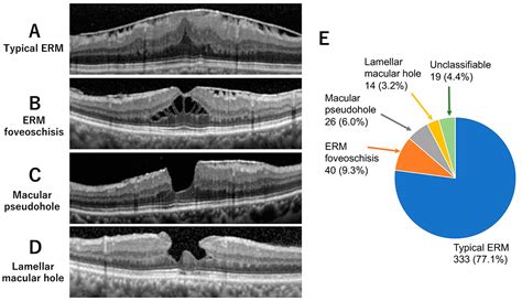 JCM | Free Full-Text | Comparisons of Clinical Characteristics and ...