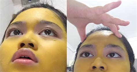 Woman's Face Becomes an 'Emoji' After Doing a Turmeric Face Mask