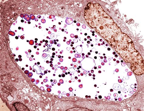 Chlamydia Trachomatis Bacteria, Tem Photograph by Biomedical Imaging Unit, Southampton General ...