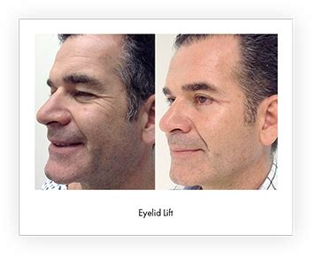 Plastic Surgeon in Guadalajara | Nashielli Plastic Surgery