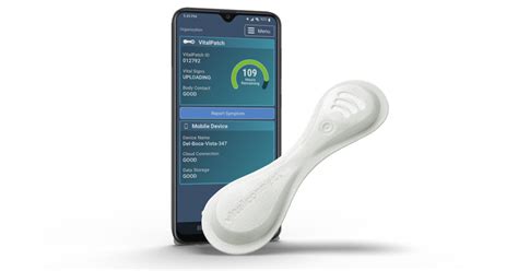 VitalConnect launches VitalPatch RTM for extended Holter monitoring ...