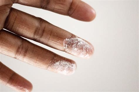 5 Talcum Powder Alternatives | MedTruth - Prescription Drug & Medical ...