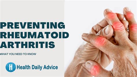 Preventing Rheumatoid Arthritis: What You Need to Know