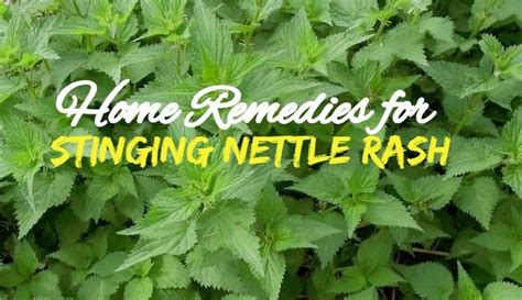 Stinging Nettle Treatment ( Best Remedies That Work)