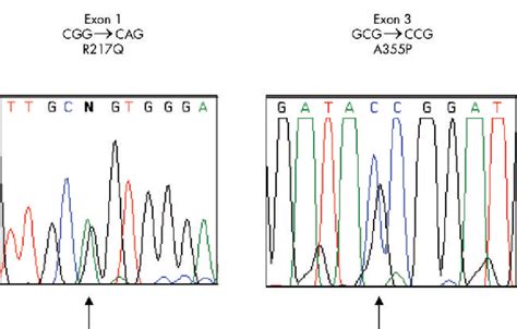 Mutations in tyrosinase gene. | Download Scientific Diagram