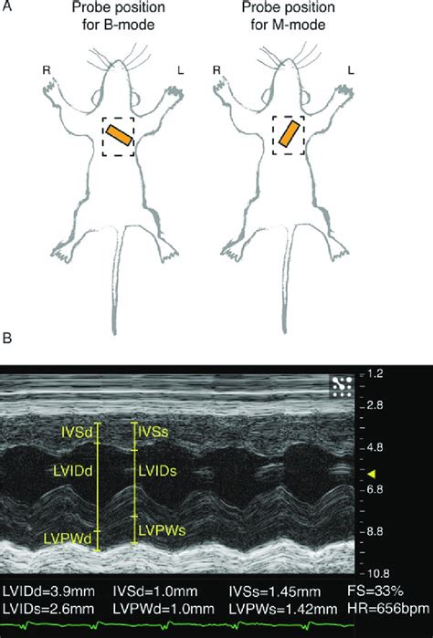 Echocardiography recording and analysis. (A) Approximate positioning of ...