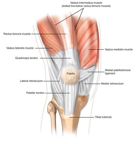 Medial Patellofemoral Ligament