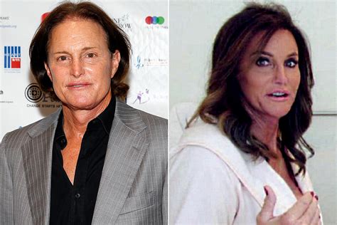 Caitlyn Jenner Plastic Surgery Before and After | Celebrity Bad ...