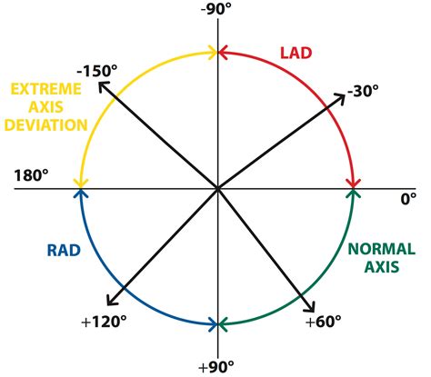 The Basics of ECG Interpretation (Part 2 – Rate, Rhythm and Axis) - Medical Exam Prep