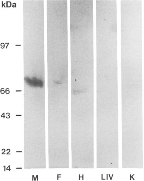 Figure 1 from The 72-kilodalton protein of the male reproductive tract ...