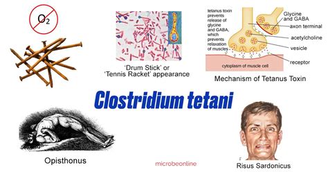 Clostridium tetani: Properties, Pathogenesis, Lab Diagnosis • Microbe ...