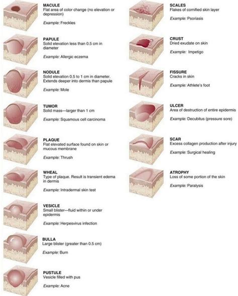 Types of Skin Lesions : coolguides | Skin anatomy, Wounds nursing, Skin ...