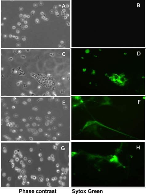 Induction of neutrophil extracellular traps by different concentrations... | Download Scientific ...