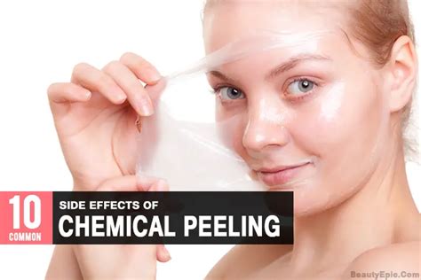 10 Common Side Effects Of Chemical Peeling